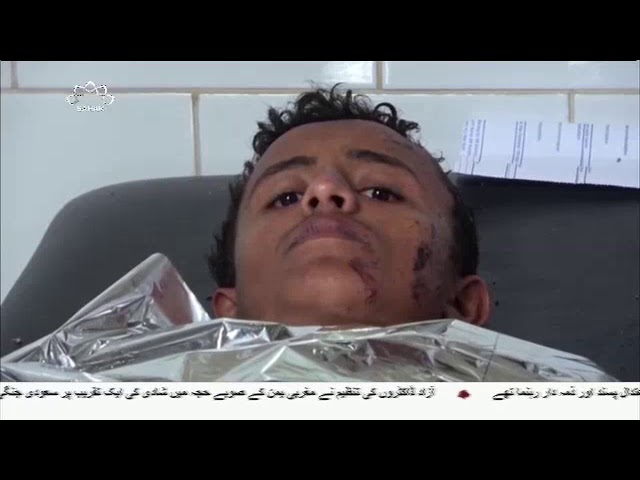 [25APR2018] یمن میں شادی کی تقریب پر سعودی حملے کی شدید مذمت  - Urdu