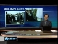 Iran Ends US Eye Bio Implants Monopoly - English