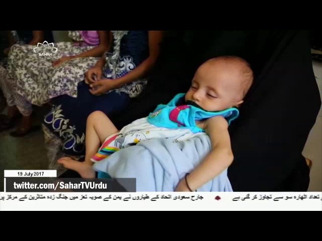 [19Jul2017] یمن میں ہیضے سے مرنے والوں کی تعداد میں اضافہ - Urdu