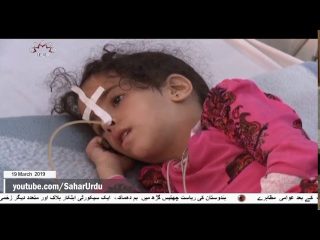 [19Mar2019] گذشتہ ایک سال میں ایک لاکھ یمنی بچے سعودی جارحیت  - Urdu