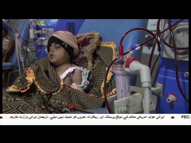 [31Dec2017] یمن کے شمال مغربی علاقے پر وحشیانہ سعودی حملہ- Urdu