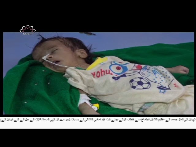 [12Oct2018] سعودی حکومت یمنی بچوں کی قاتل- Urdu