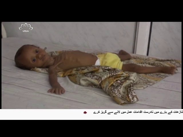 [17Jan2018] یمن میں وبائی مرض پھیلنے پر عالمی ادار صحت کا انتباہ - Urdu