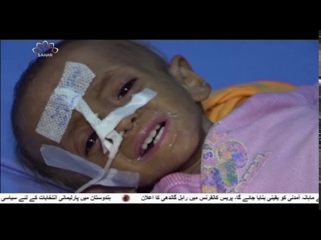 [25Mar2019] یمن پر سعودی اتحاد کی جارحیت کے چار برس - Urdu