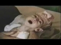 Depleted Uranium 3 of 3 - Disturbing Images - English