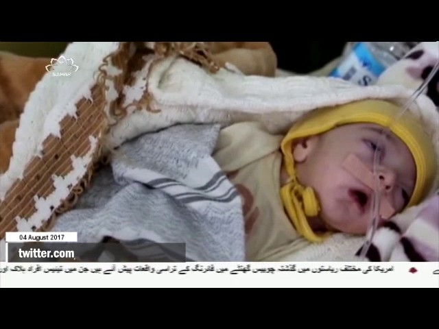 [04Aug2017] ستر لاکھ یمنی شہریوں کو موت کے خطرے کا سامنا : اقوام متحدہ - Ur