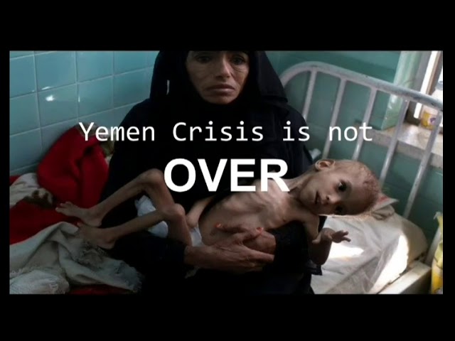 Yemen Crisis not Over!-English