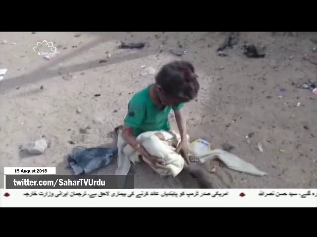 [15Aug2018] یونیسف کی جانب سے یمنی بچوں پر سعودی حملوں کی مذمت- Urdu
